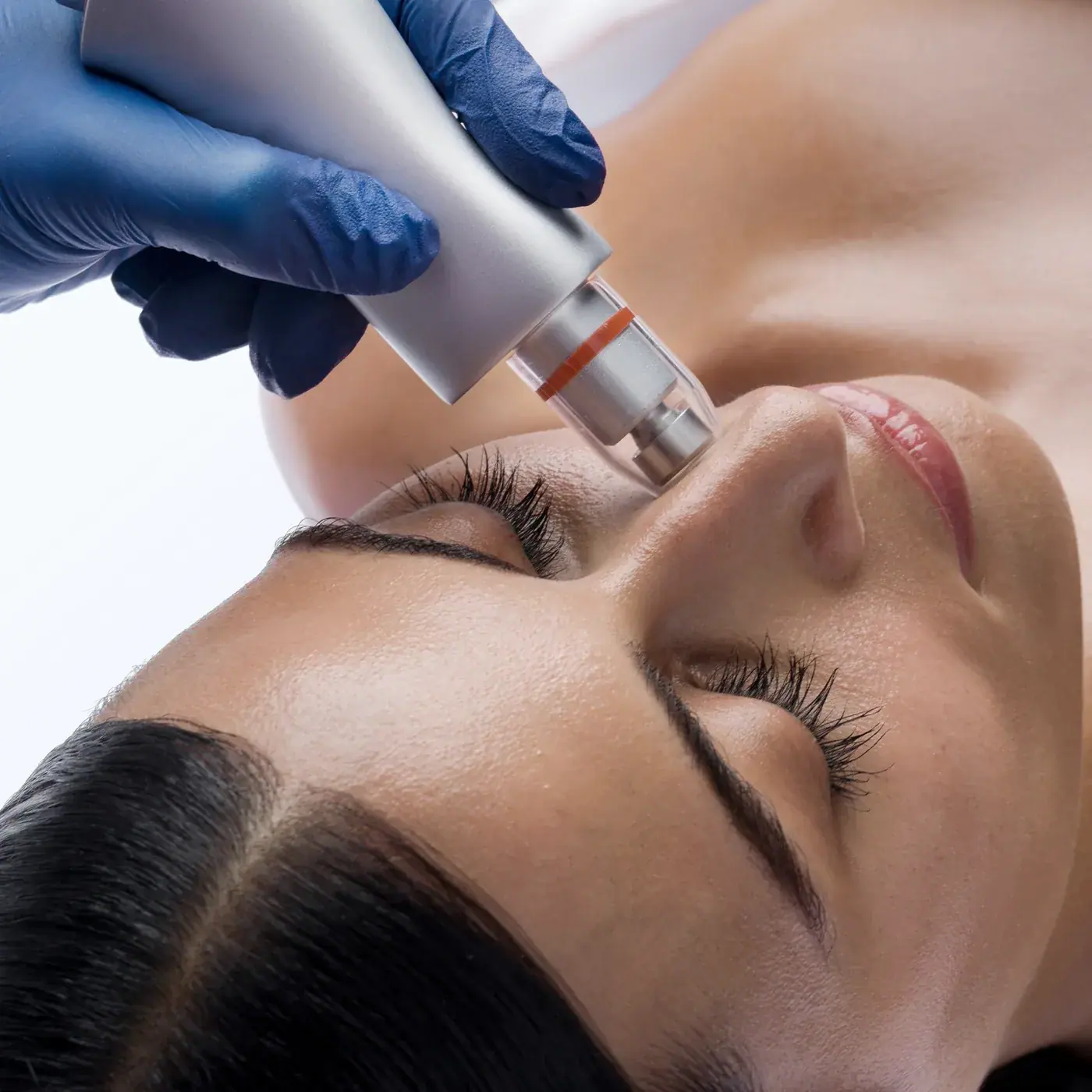 Bio-Therapeutic Bio-Brasion GEN4, detail view