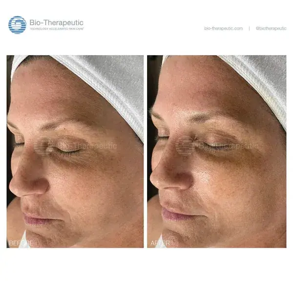 Bio-Therapeutic bt-accent AIR, packaging view