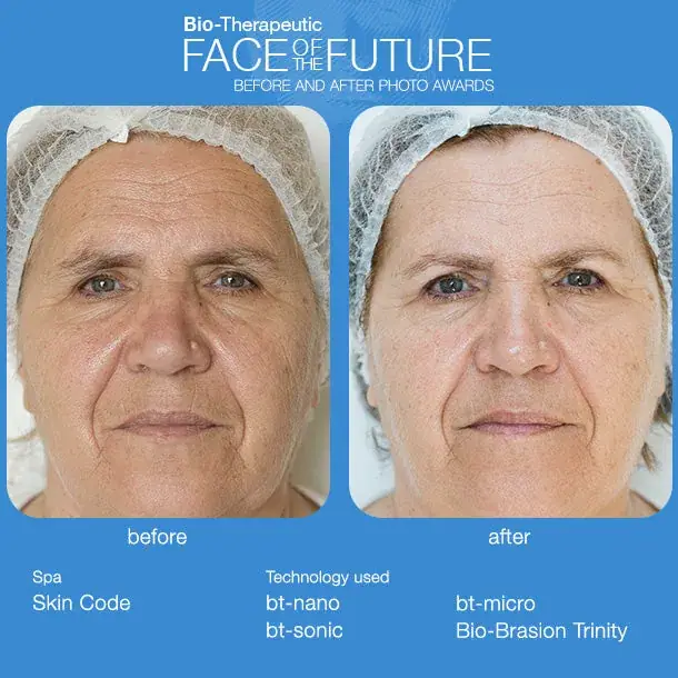 Bio-Therapeutic bt-sonic 6 pack, lifestyle view