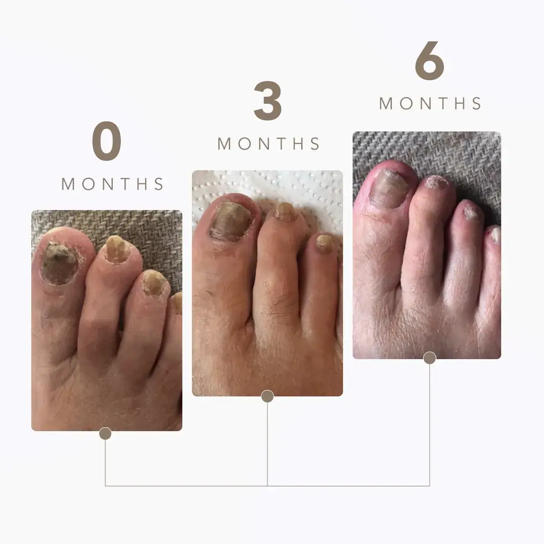 Margaret Dabbs London Nail Fungus Laser Device, texture view