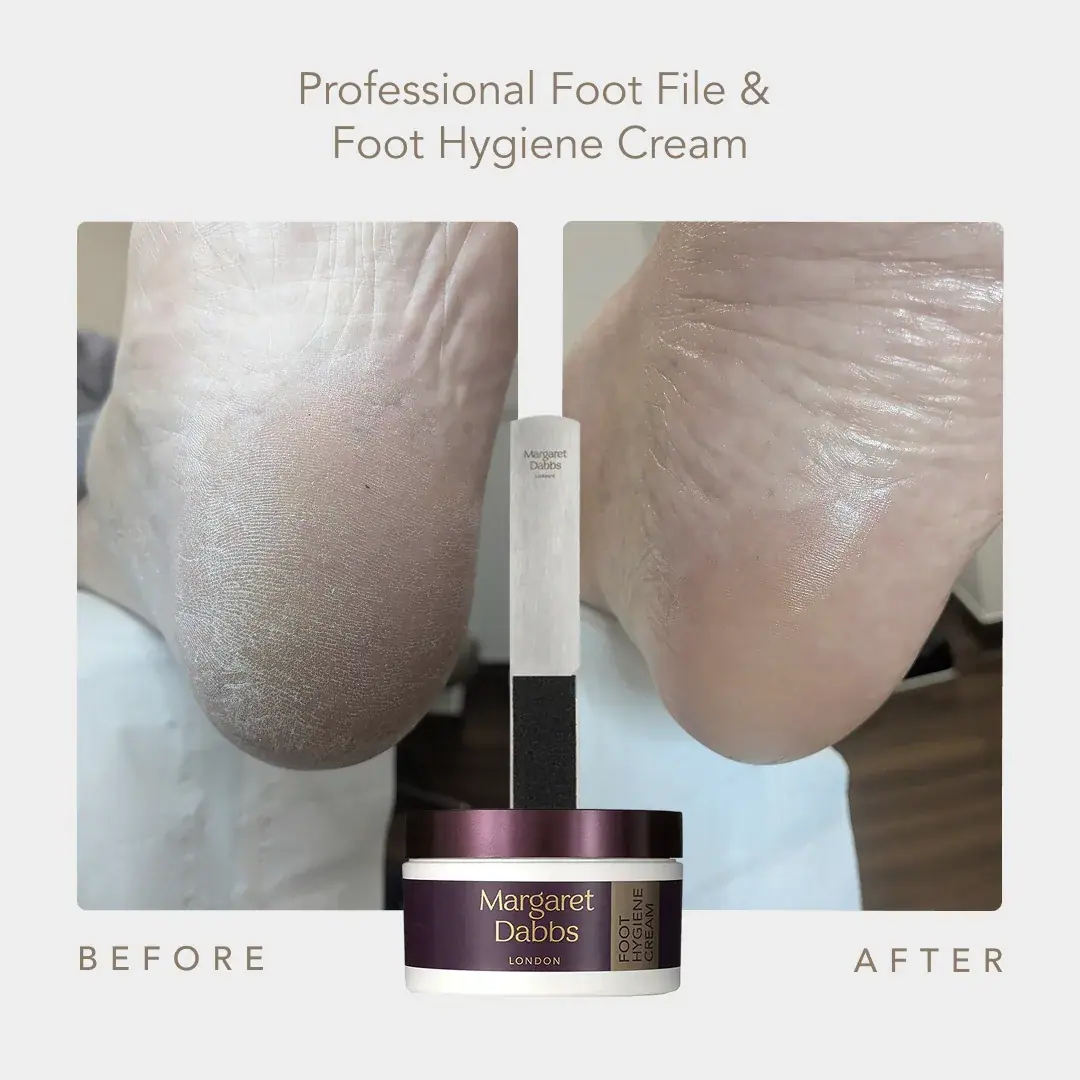 Margaret Dabbs London Supersize Foot Hygiene Cream 150ml, packaging view