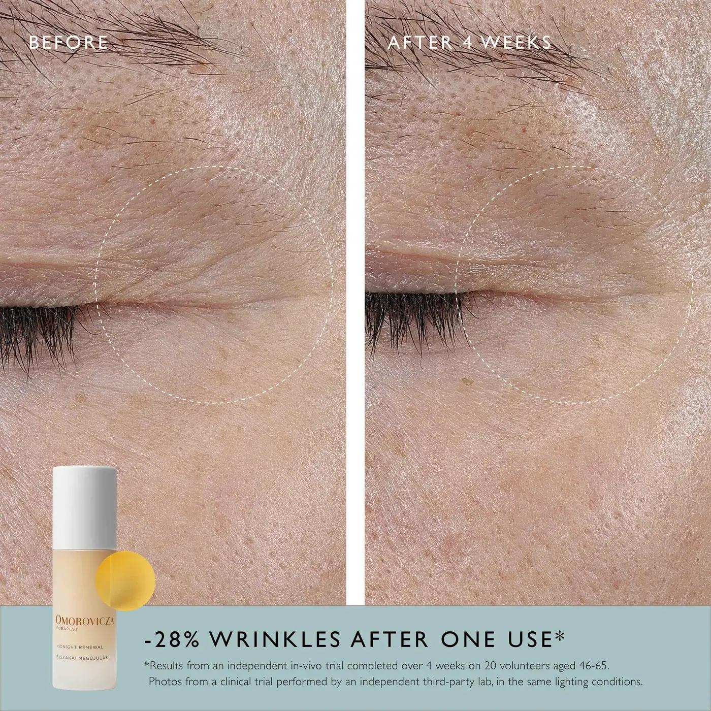 Omorovicza Midnight Renewal Serum 30ml, lifestyle view