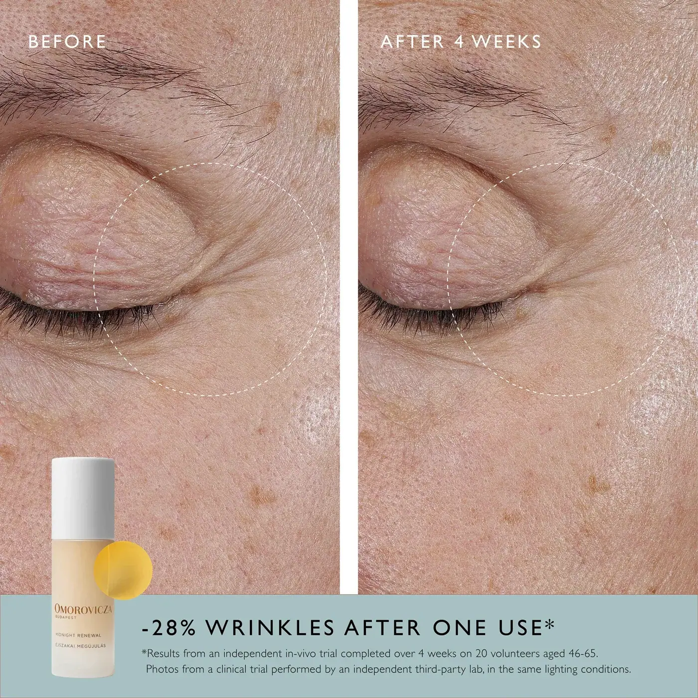 Omorovicza Midnight Renewal Serum 30ml, packaging view