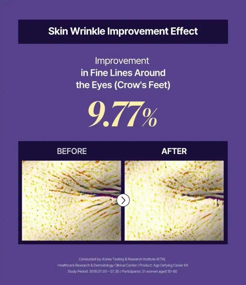 OxygenCeuticals Age Defying Caviar Cream, lifestyle view