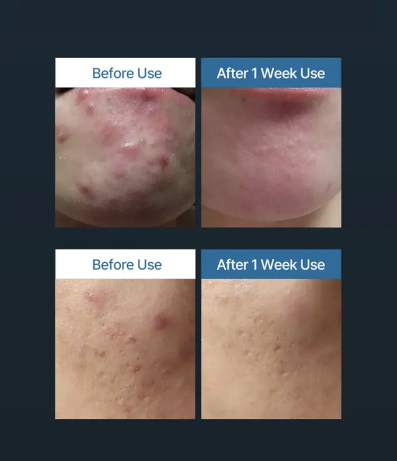 OxygenCeuticals i Fill Toner Pad, packaging view