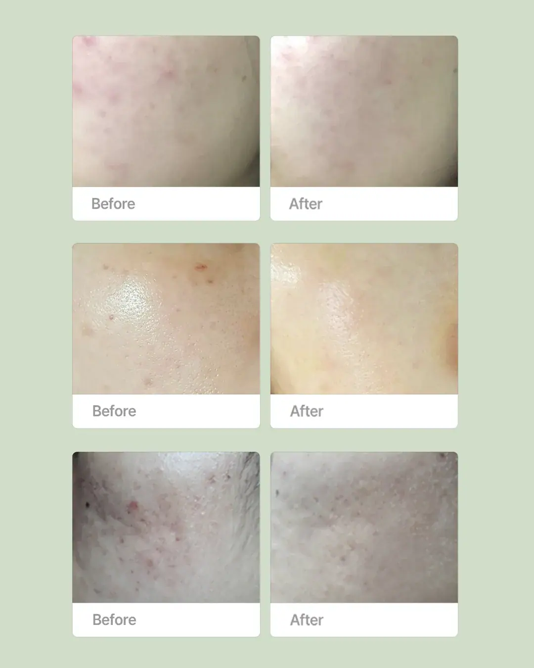 OxygenCeuticals Purifying Kit, lifestyle view