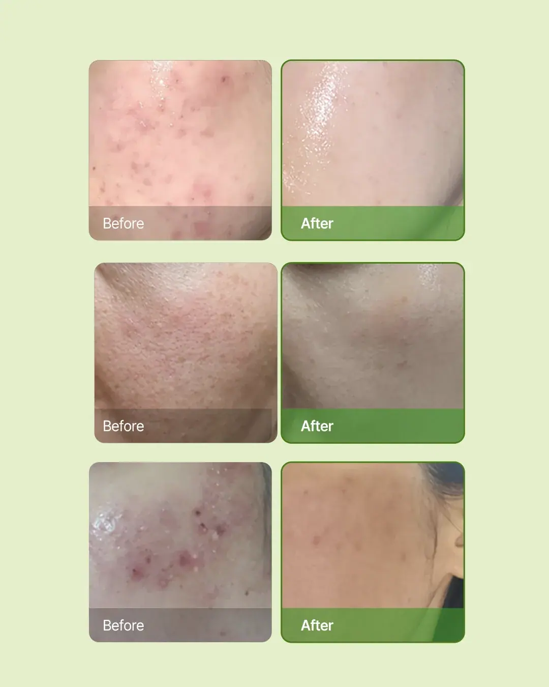 OxygenCeuticals Skin Barrier Kit, packaging view